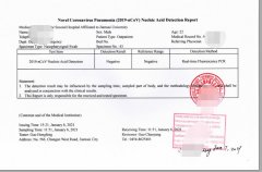 核酸檢測(cè)報(bào)告翻譯的注意事項(xiàng)
